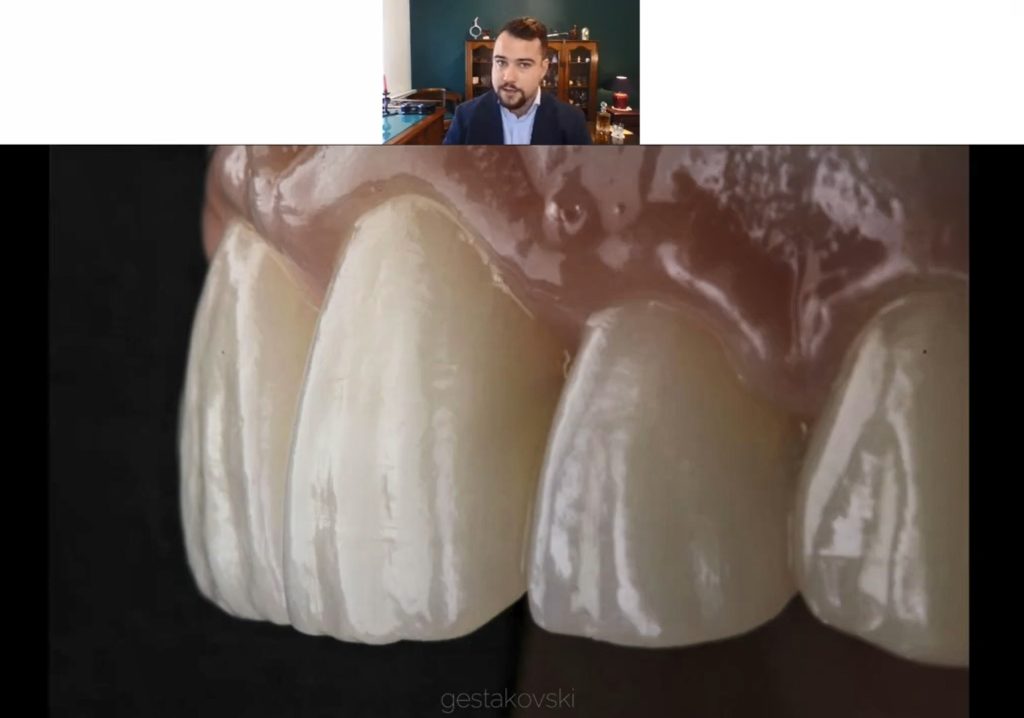 Composite Veneers Injectable Technique Masterclass Recording