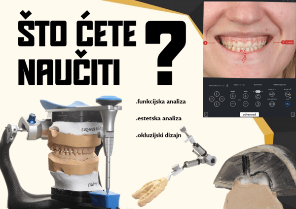 [Beograd - 20.06.2025.] Hibridni hands-on tečaj: Kompozitni table-tops - injekcijska tehnika na distalnim zubima - FUNKCIJSKI PROGRAM (+ 6 sati teorije) - Image 11