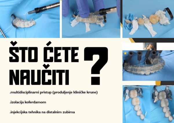 [Beograd - 20.06.2025.] Hibridni hands-on tečaj: Kompozitni table-tops - injekcijska tehnika na distalnim zubima - FUNKCIJSKI PROGRAM (+ 6 sati teorije) - Image 14