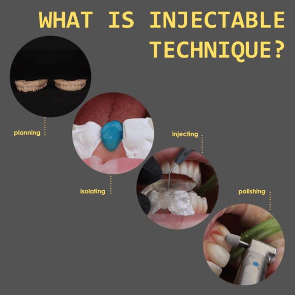 [Zagreb INTERNATIONAL – 06.06.2025.] -  Comprehensive Hands-on course: Composite veneers - Injectable technique (English language) + 8 hours theory online - Image 7