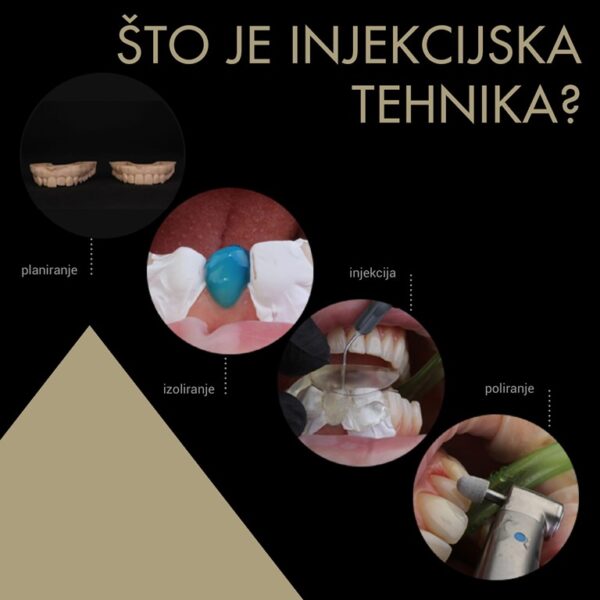 [Beograd - 21.06.2025.] Hibridni hands-on tečaj: Kompozitne ljuskice - injekcijska tehnika (+ 8 sati teorije online) - Image 8