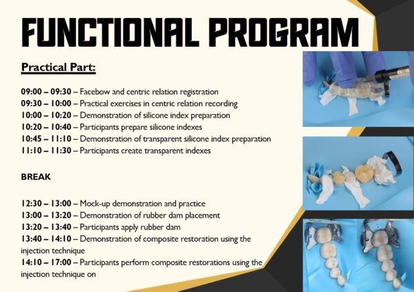 [Zagreb INTERNATIONAL - 07.06.2025.] Comprehensive Hands-on course: Composite tabletops in oral rehabilitation – Injectable technique (English language) + 6 hours theory online - Image 10